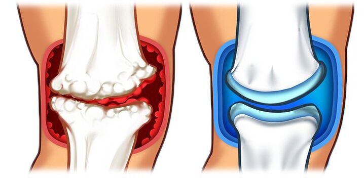 การกู้ร่วมหลังจากจบหลักสูตร Ostelife Premium Plus
